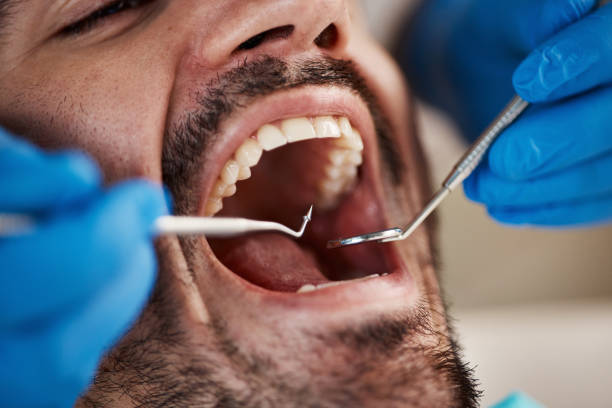 Best Emergency Treatment for Toothache in Sterling City, TX
